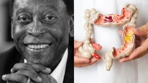 Pelé volta a ser internado para tratamento contra câncer em SP
