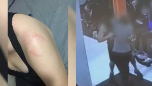 Jovem leva mordida em academia após esbarrar em homem