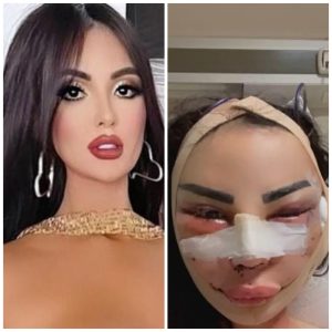 Susi Humana denuncia maus-tratos na Turquia