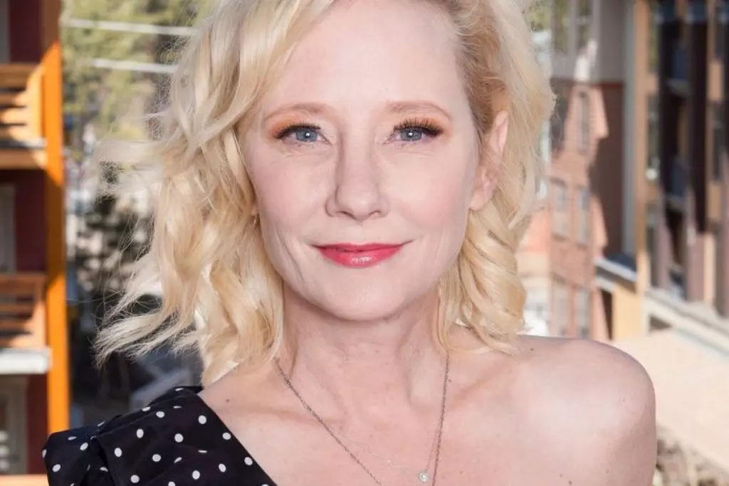 Anne Heche, Atriz Anne Heche, Anne Heche, Anne Heche idade, Anne heche morreu