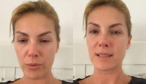 Veja o que Ana Hickmann disse após ser agredida pelo marido
