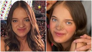 Rafaella Justus faz rinoplastia e resultado IMPRESSIONA